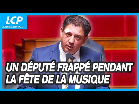 Un député frappé pendant la fête de la musique dénonce "une culture de l'ultraviolence" - 24/06/2025