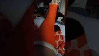 i broke my leg?! This is my first video so might be a bit crap.
