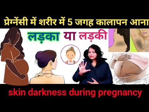 प्रेग्नेंसी में इन 5 अंगों में कालापन आने से लड़का होता है जानिए सच्चाई? skin darkness in pregnancy।