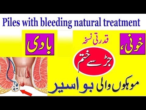 Hemorrhoid / Piles with bleeding natural treatment In...