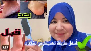 أخر ما كاين والنتيجة  فالحين عمرك باقي تحكي قدمين ديالك بالماء والصابون غادي تهناي من تشققات قدمين