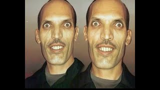 ALEX KARTELA - BLIZNACITE DISS
