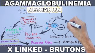 Agammaglobulinemia | Pathophysiology Mechanism and Pathway
