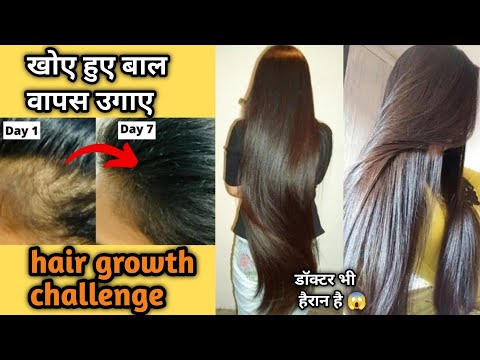 मात्र 2 रुपये मै रातों रात अपने बालों को बढ़ाये 😱🔥लम्बे,काले,ओर घने बाल होंगये आप के भी💕गारंटी है