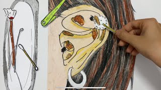 [🌸paper diy🌸] Ear cleaing 🦻🏻and big ear wax removal ASMR ❌ No music | Ngongem vlog