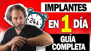 Descubre los Implantes dentales en un día, ¡Sí en 24 horas!, Carga Inmediata en Implantes Dentales