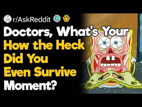 Doctors, What's Your "How The Heck Did You Even Survive" Moment?