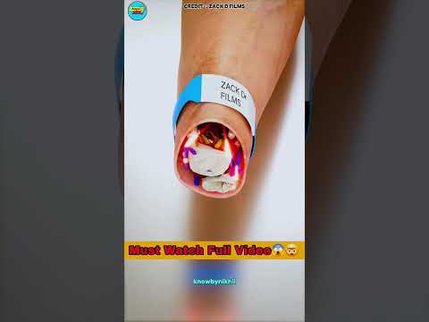 How A Hand Transplant Works in 3D Animation #shortvideo