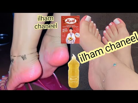 ربع كوب خل وقولي وداعآ لتشققات وخشونه القدمين مجربة مني شخصيآ تقشير . تبييض . ترطيب . بياض كاتلج