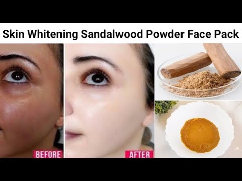 आपकी स्किन चमकेगी| Dark Spots, चेहरे का कालापन आसानी से ख़त्म करे घर पर | Whiten Skin tone