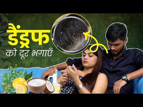 Dandruff को कहें अलविदा! रूसी से छुटकारा पाएं इन 5 आसान और असरदार नुस्खों से - – बिना केमिकल्स के