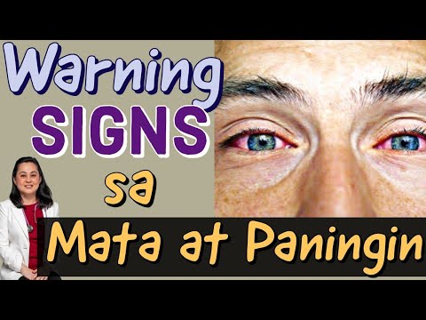 Warning Signs sa Mata at Paningin - Payo ni Doc Liza Ramoso-Ong