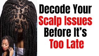 "Crown Clarity: Decode Your Scalp Issues" Mini-Webinar