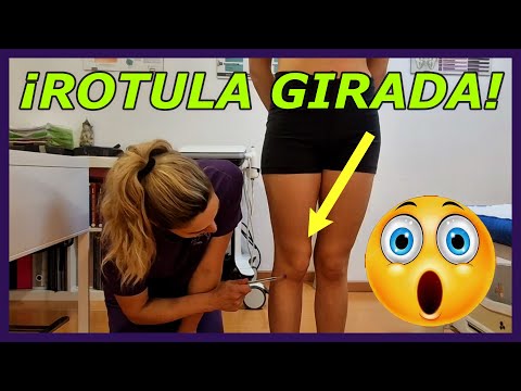 Rótula desviada 🦵❌ Dolor de rodilla al caminar? 🚶‍♂️ Te muestro cómo lo trato de verdad 🙌🔥"#rodilla