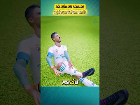 Đôi Chân Của Ronaldo Được Định Giá Bao Nhiêu!