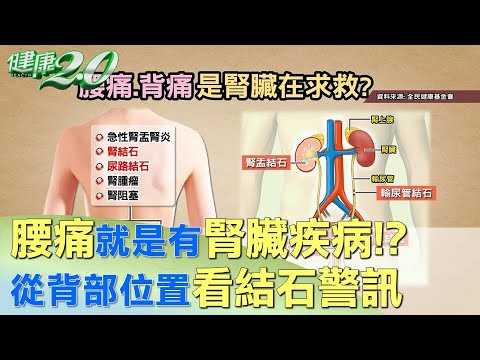 腰痛就是有腎臟疾病！？從背部位置看結石警訊 健康2.0