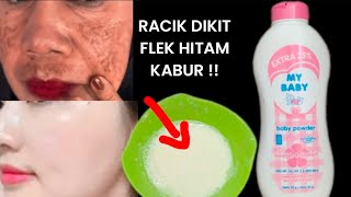 Racikan Ajaibb!! Dalam Sekejap Flek Hitam Langsung Minggat Selamanya!!