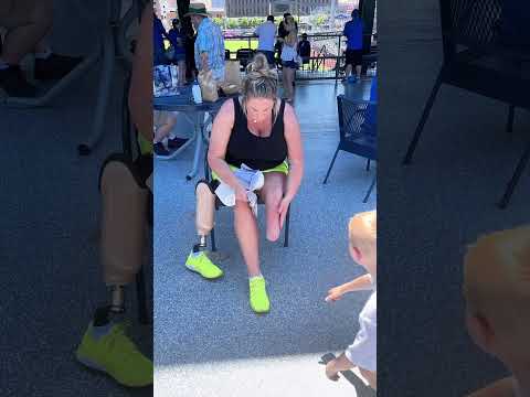 Below the knee amputee taking off prosthetic leg in public