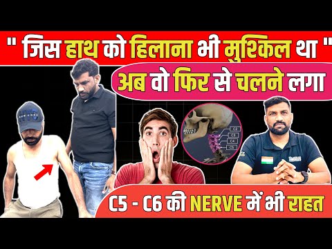 हाथ हिलना भी मुश्किल था। Physiotherapy से किया ठीक | With Patient Dr. Arvind Jaga