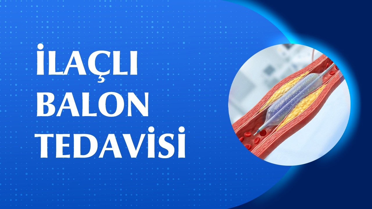 İlaçlı Balon Tedavisi Her Hastaya Uygulanır mı?