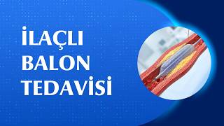 İlaçlı Balon Tedavisi Her Hastaya Uygulanır mı?