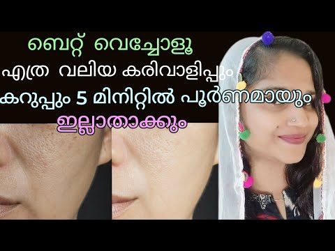 വെറും 5 മിനിറ്റ് പൂർണമായും എത്ര വലിയ കരിവാളിപ്പും ഇല്ലാതാകും|Skin whitening face pack #skincare