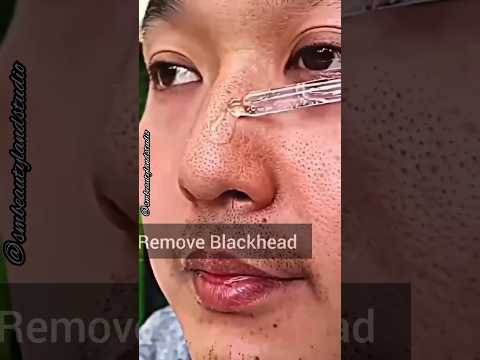 Viral Serum|2x Glowing Face|Whitening & Brightening Face Serum|SM Beautyland studio #shorts#skincare