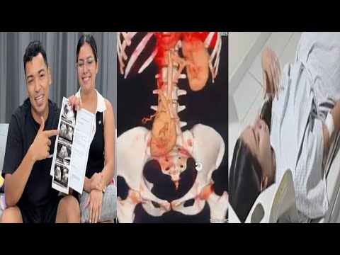 Pobre Larin Tiene Que Despedir A Su Esposa | Loca Comedias | Larin Y Amigos  | #humorlatino #2025