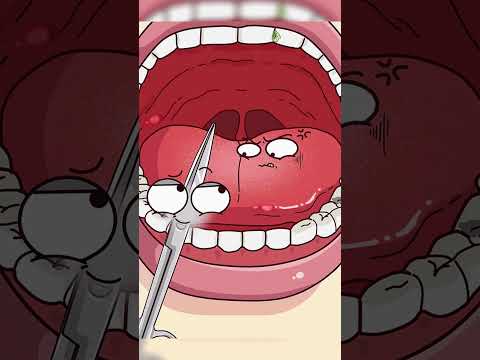 ✂️ Pourquoi couper le frein de la langue ?