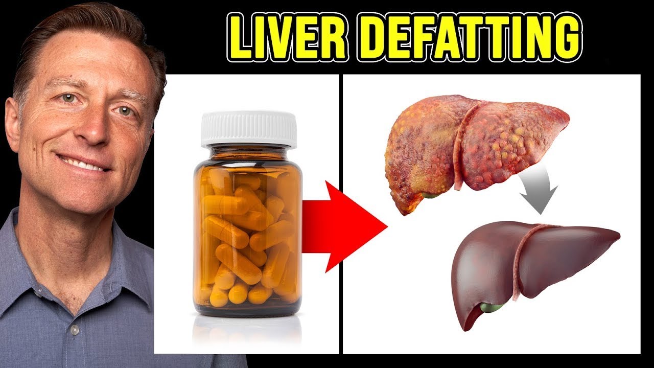 The BEST Vitamin to Cleanse a Fatty Liver – Dr. Berg