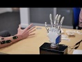 Prosthetic Hand Functionality and Challenges
