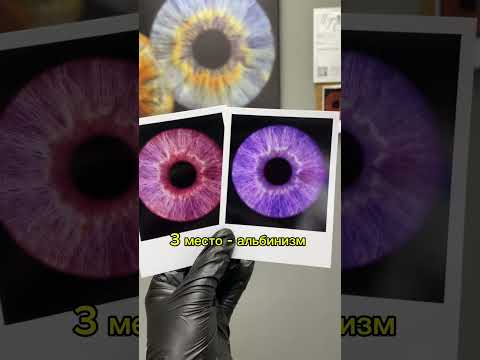 Самые редкие аномалии в глазах🤯👁️👑 #screeneyes #топ #фоторадужки #трэнды #shorts