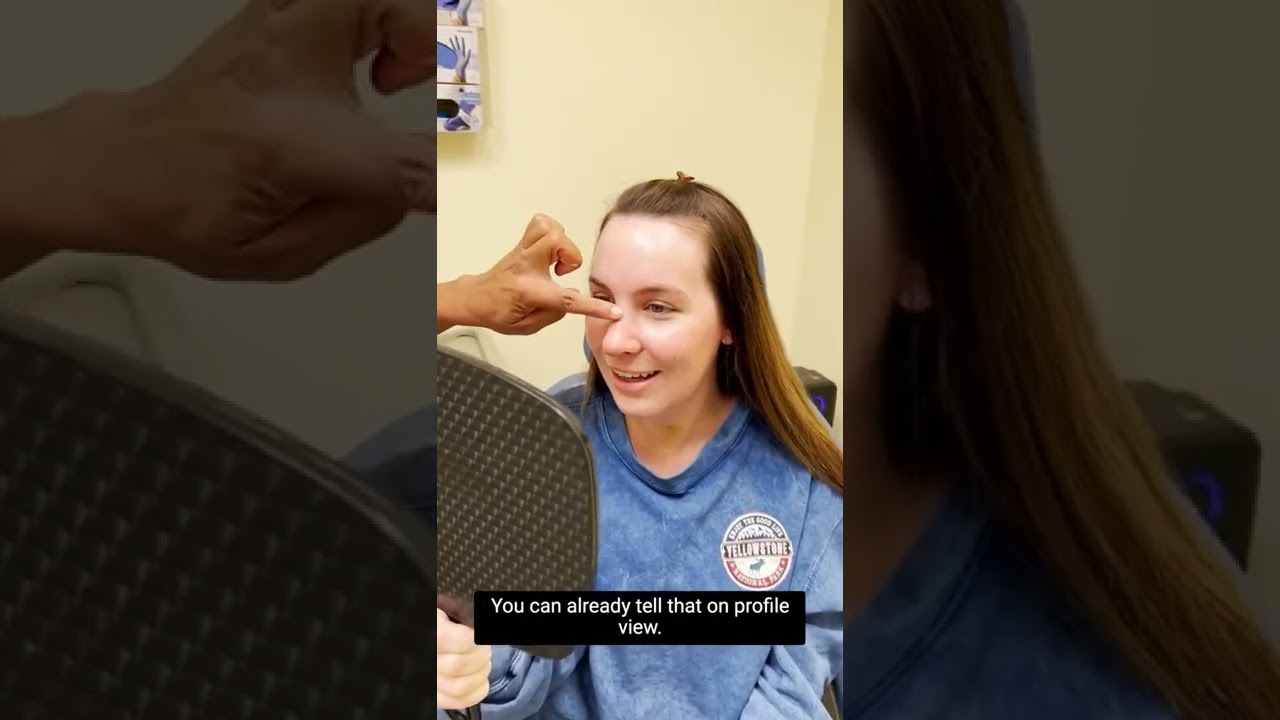 Person being helped with makeup application.
