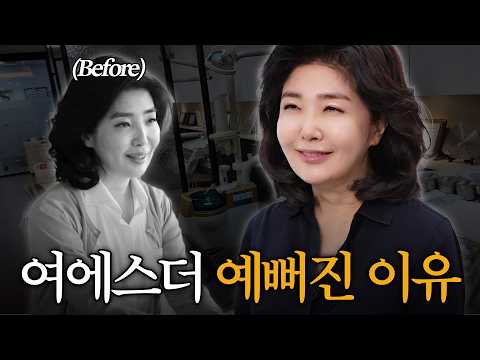 여에스더 내돈내산 교정 후기(교정 결심 이유, 교정 기간, 효과, 성형논란)
