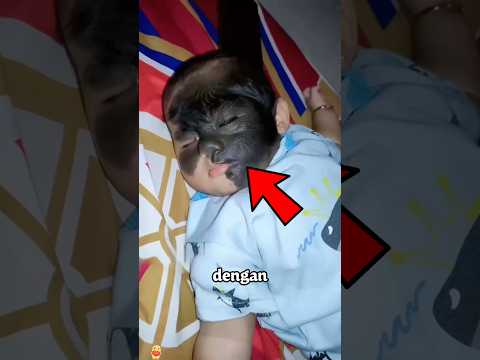 Bintik-bintik hitam di wajah anak itu mempengaruhi kesehatannya.#shorts