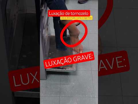 🚨 LUXAÇÃO DE TORNOZELO: Tornozelo Saiu do Lugar? Sintomas e Dor Intensa #enfermagem #short #shorts