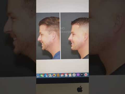 Before and after profile photo comparison.