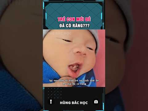 tại sao 1 số đứa trẻ mới đẻ ra đã có răng