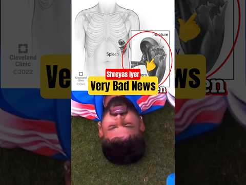 BCCI Confirms: Shreyas Iyerโs Injury Is More Serious Than Expected! #shorts