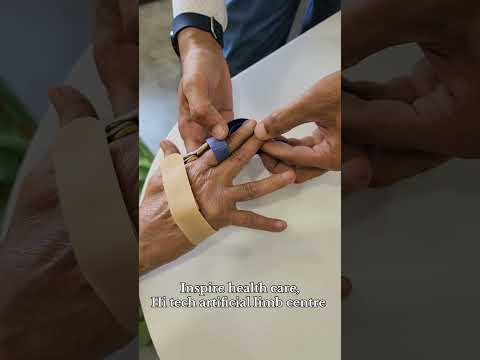 Dynamic hand splint for Rheumatoid arthritis #orthosis #splint #lifehacks #effectivesolutions