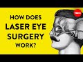 Vision Correction Techniques and Risks