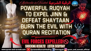 Ruqyah to Burn & Expel Jinn🔥 Powerful Quranic Verses to Torment & Expel Jinn, Sihr & Evil Entities