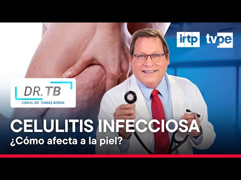 Sigue estas recomendaciones para evitar la celulitis infecciosa