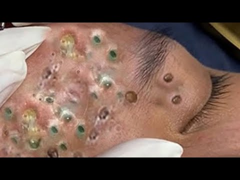 طرق حماية بشرة الوجهCC333