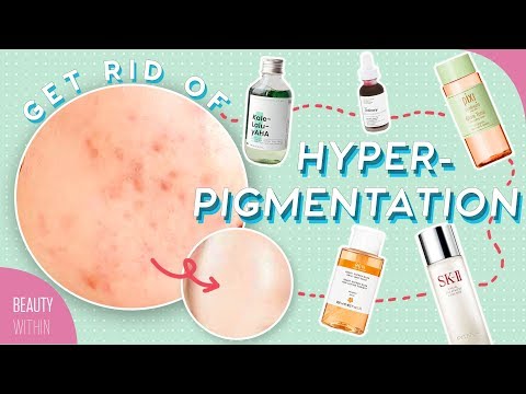 Best Ways to Reduce Hyperpigmentation & Dark Spots: Ingredients, Products & Natural Remedies