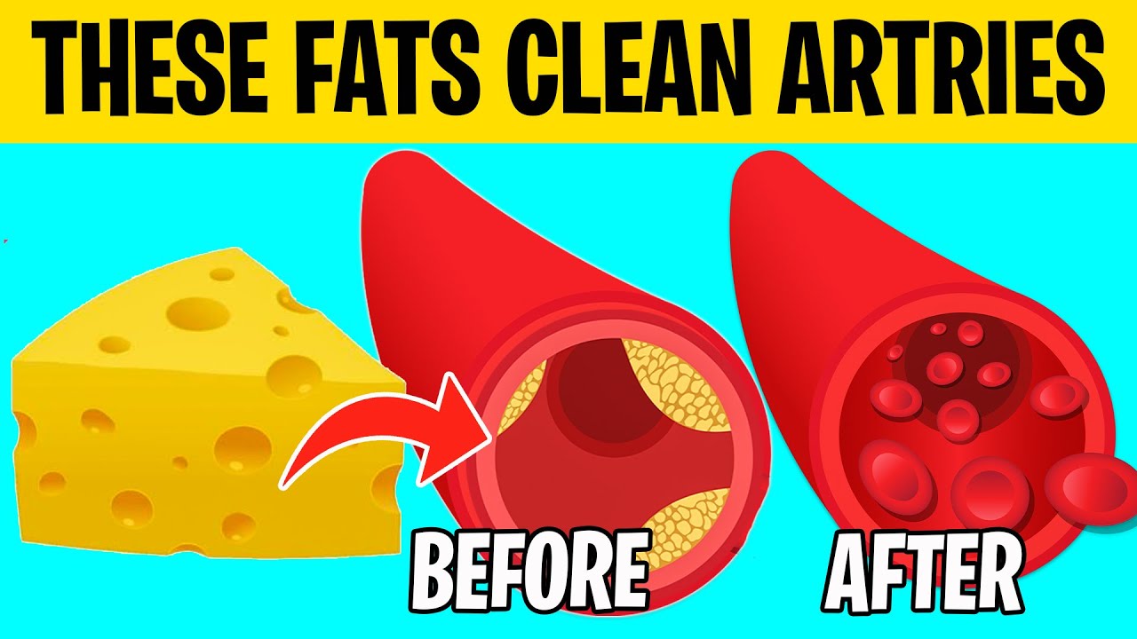 10 Healthy FATS That CLEAN OUT Arteries NATURALLY