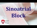 Understanding Sinoatrial Block