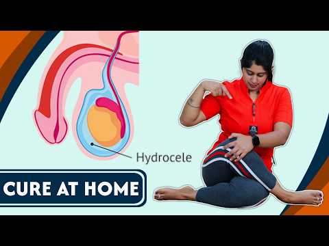 इन योग से ठीक होगा हाइड्रोसील घर बैठे | Best YOGA POSES to CURE Hydrocele at Home FAST | @Yogawale