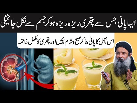 Kidney Stone Treatment | Kidney Stone Ko Remove Karne Ka Tarika | Pathri Ka ilaaj By Dr Sharafat Ali