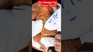 😲 Ancient BLACKHEADS REMOVAL - Oldest Blackheads Ever #shorts